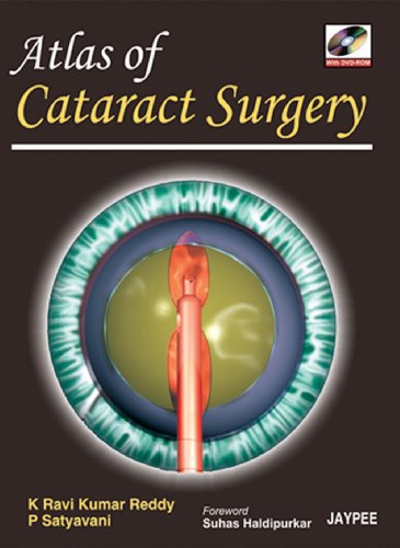 Stock image for Atlas of Cataract Surgery for sale by Books Puddle