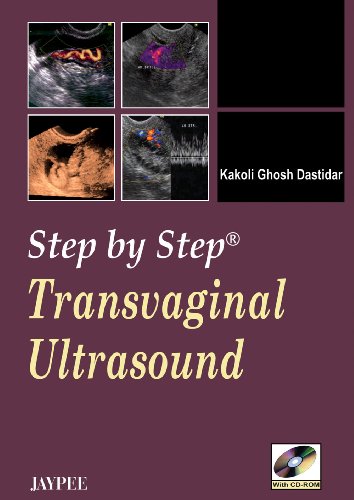 9788184483222: Transvaginal Ultrasound (Step by Step)