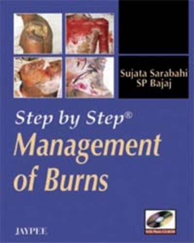 9788184483604: Management of Burns (Step by Step)