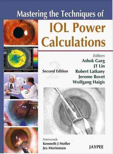9788184483802: Mastering the Techniques of Intraocular Lens Power Calculations