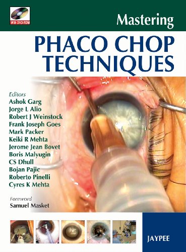9788184483819: Mastering Phaco Chop Techniques