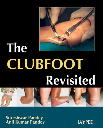 The Club Foot Revisited (9788184484359) by Pandey, Sureshwar; Pandey, Anil Kumar, Ph.D.