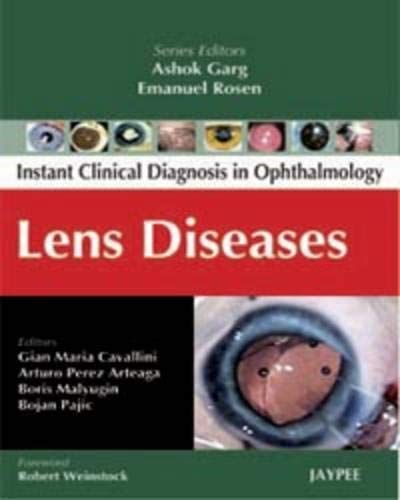 Stock image for Lens Diseases for sale by Books Puddle