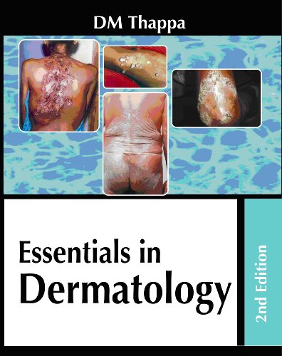 Stock image for Essentials in Dermatology for sale by dsmbooks