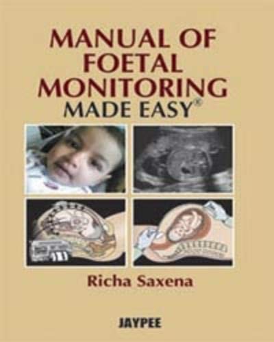 Stock image for MANUAL OF FOETAL MONITORING MADE EASY for sale by Basi6 International
