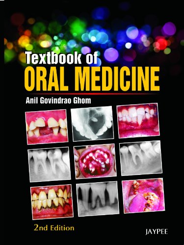 9788184487008: Textbook of Oral Medicine