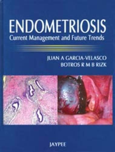 Imagen de archivo de Endometriosis : Current Management and Future Trends a la venta por Better World Books