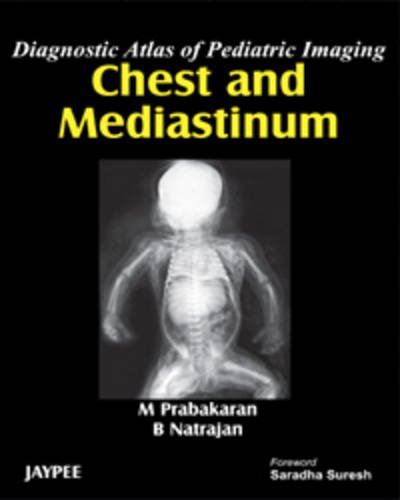 Stock image for Diagnostic Atlas of Pediatric Imaging Chest and Mediastinum for sale by Books Puddle