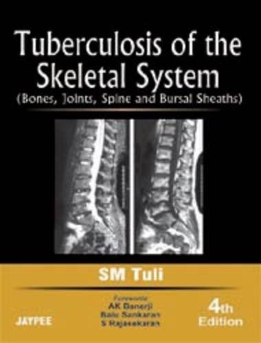 9788184488364: Tuberculosis of the Skeletal System: Bones, Joints, Spine and Bursal Sheaths