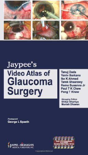 9788184488555: Jaypee's Video Atlas of Glaucoma Surgery