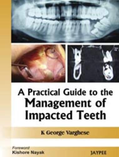 9788184488784: A Practical Guide to the Management of Impacted Teeth