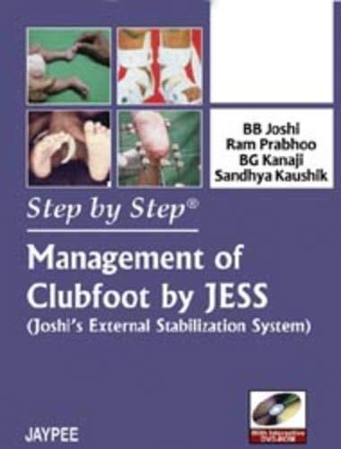 Stock image for Management of Clubfoot by Jess (Joshi's External Stabilization System) (Step by Step) for sale by Revaluation Books