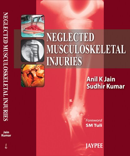 Neglected Musculoskeletal Injuries (9788184488890) by Jain, Anil K.; Kumar, Sudhir