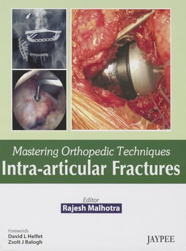 Beispielbild fr Mastering Orthopedic Techniques IntraArticular Fractures zum Verkauf von Buchpark