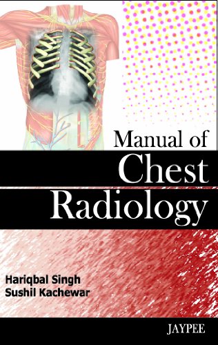 9788184489064: Manual of Chest Radiology