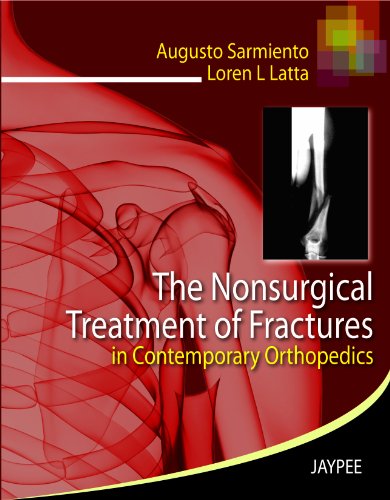 Stock image for The Nonsurgical Treatment of Fractures in Contemporary Orthopedics for sale by Revaluation Books