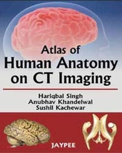 Beispielbild fr Atlas of Human Anatomy on Ct Imaging zum Verkauf von Anybook.com