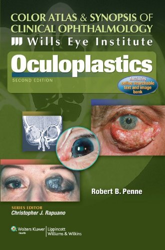 Imagen de archivo de Oculoplastics:C A & Synopsis-Wills Eye Institu 2/e a la venta por dsmbooks