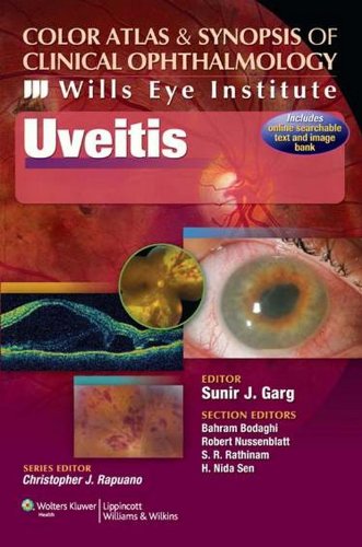 9788184737226: Color Atlas & Synopsis of Clinical Ophthalmology (Wills Eye Institute)-Uveitis