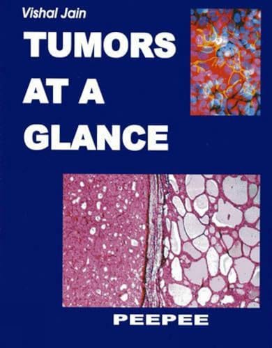 9788188867165: Tumors at a Glance: Volume 1