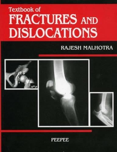 9788188867578: Textbook of Fractures and Dislocations: Volume 1