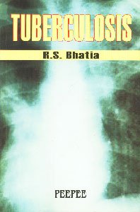 9788188867981: Tuberculosis