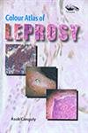 Colour Atlas of Leprosy