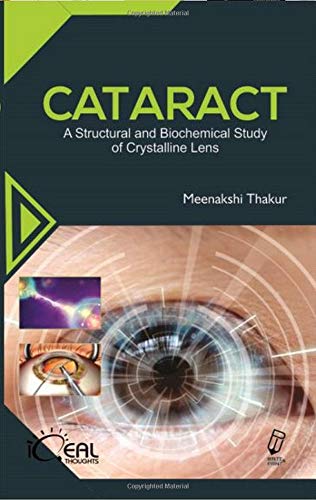 Imagen de archivo de Cataract A Structural And Biochemical Study of Crystalline Lens a la venta por Books in my Basket