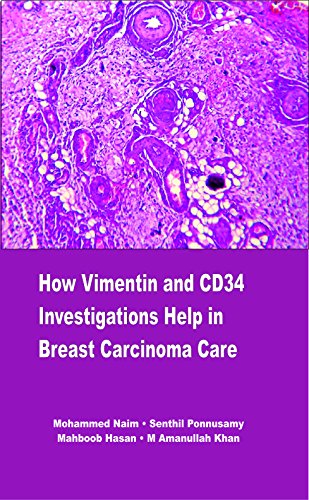 Stock image for How Vimentin and CD34 Investigations help in Breast Carcinoma Care for sale by Majestic Books