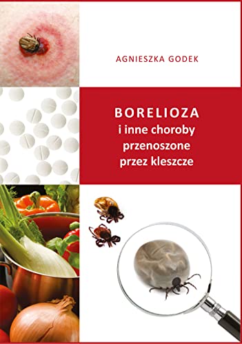 Beispielbild fr Borelioza i inne choroby przenoszone przez kleszcze zum Verkauf von Buchpark