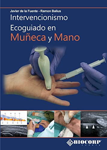 Stock image for Intervencionismo Ecoguiado en Mueca y Mano for sale by AG Library