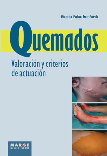 Imagen de archivo de Quemados. Valoracin y criterios de actuacin: Valoracin y criterios de actuacin (Spanish Edition) a la venta por Ebooksweb