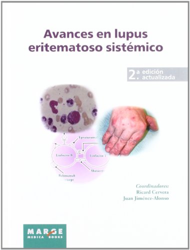 Beispielbild fr Avances en lupus eritematoso sistémico (Spanish Edition) [Hardcover ] zum Verkauf von booksXpress