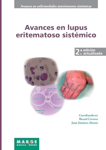 Imagen de archivo de Avances en lupus eritematoso sistémico (Spanish Edition) [Hardcover ] a la venta por booksXpress