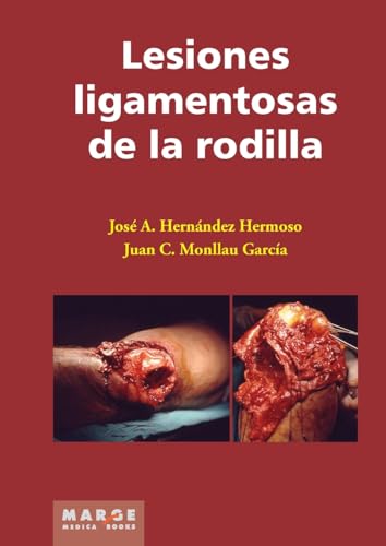 Beispielbild fr Lesiones ligamentosas de rodilla (Spanish Edition) zum Verkauf von California Books