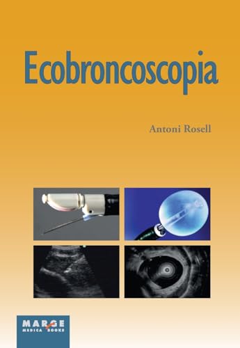 9788415340270: Ecobroncoscopia (MEDICINA Y CIENCIAS DE LA SALUD)