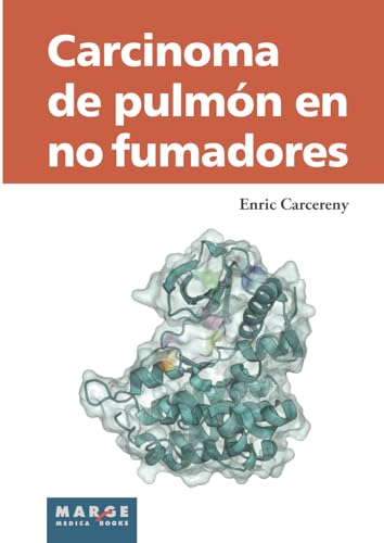 9788415340706: Carcinoma de pulmn en no fumadores