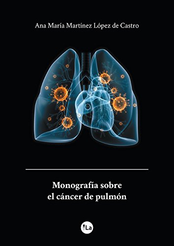 Imagen de archivo de Monografa sobre el cncer de pulmn a la venta por Librera Prez Galds