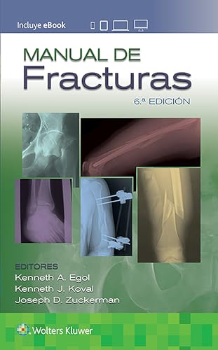 

Manual de fracturas/ Handbook of Fractures -Language: spanish