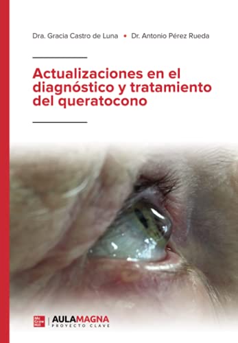 Stock image for Actualizaciones en el diagnstico y tratamiento del queratocono (Spanish Edition) for sale by Book Deals