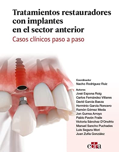 Stock image for Tratamientos restauradores con implantes en el sector anterior. Casos clnicos paso a paso. for sale by AG Library