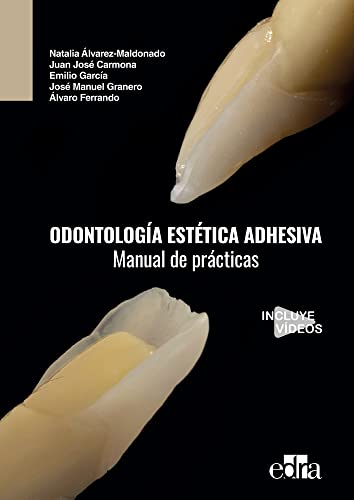 Stock image for ODONTOLOGA ESTTICA ADHESIVA. MANUAL DE PRCTICAS for sale by Antrtica