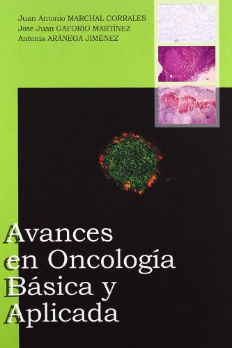 Imagen de archivo de AVANCES EN ONCOLOGIA BASICA Y APLICADA a la venta por KALAMO LIBROS, S.L.