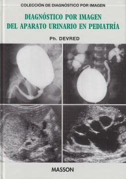 Stock image for Diagnostico por Imagen Del Aparatourinario en Pediatria for sale by Hamelyn
