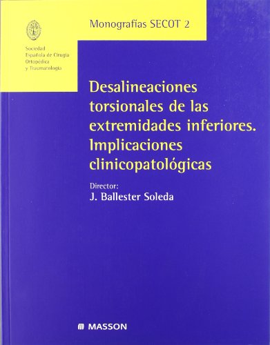 Beispielbild fr Desalineaciones torsionales de las extremidades inferiores zum Verkauf von Iridium_Books
