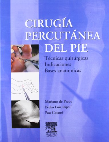 9788445812846: Ciruga percutnea del pie : tcnicas quirrgicas indicaciones: bases anatmicas