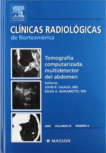 9788445816547: Clnicas Radiolgicas de Norteamrica 2005. Volumen 43 n. 6: Tomografa computarizada multidetector del abdomen