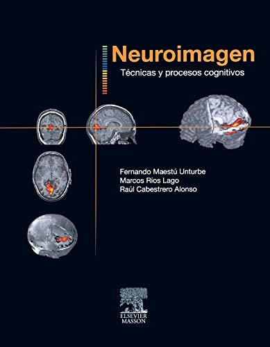 9788445817766: Neuroimagen : tcnicas y procesos