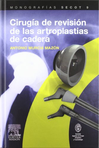 Beispielbild fr Ciruga de revisin de las artroplastias de cadera zum Verkauf von Iridium_Books