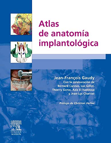 9788445817964: Atlas de anatoma implantolgica